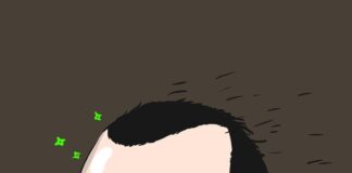 Healing Journey: Understanding the Recovery Process of FUE Hair Transplant