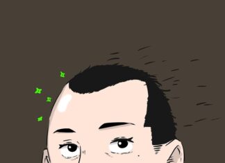 Healing Journey: Understanding the Recovery Process of FUE Hair Transplant